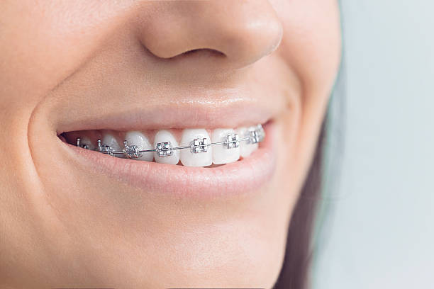 Dental Inlays and Onlays in Senatobia, MS